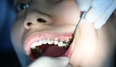 how to cut braces wire